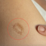 Unveiling the True Meaning Behind the Tiny Scar on Your Upper Left Arm!