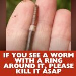 If You See A Worm With A Ring Around It, Please Kill It ASAP