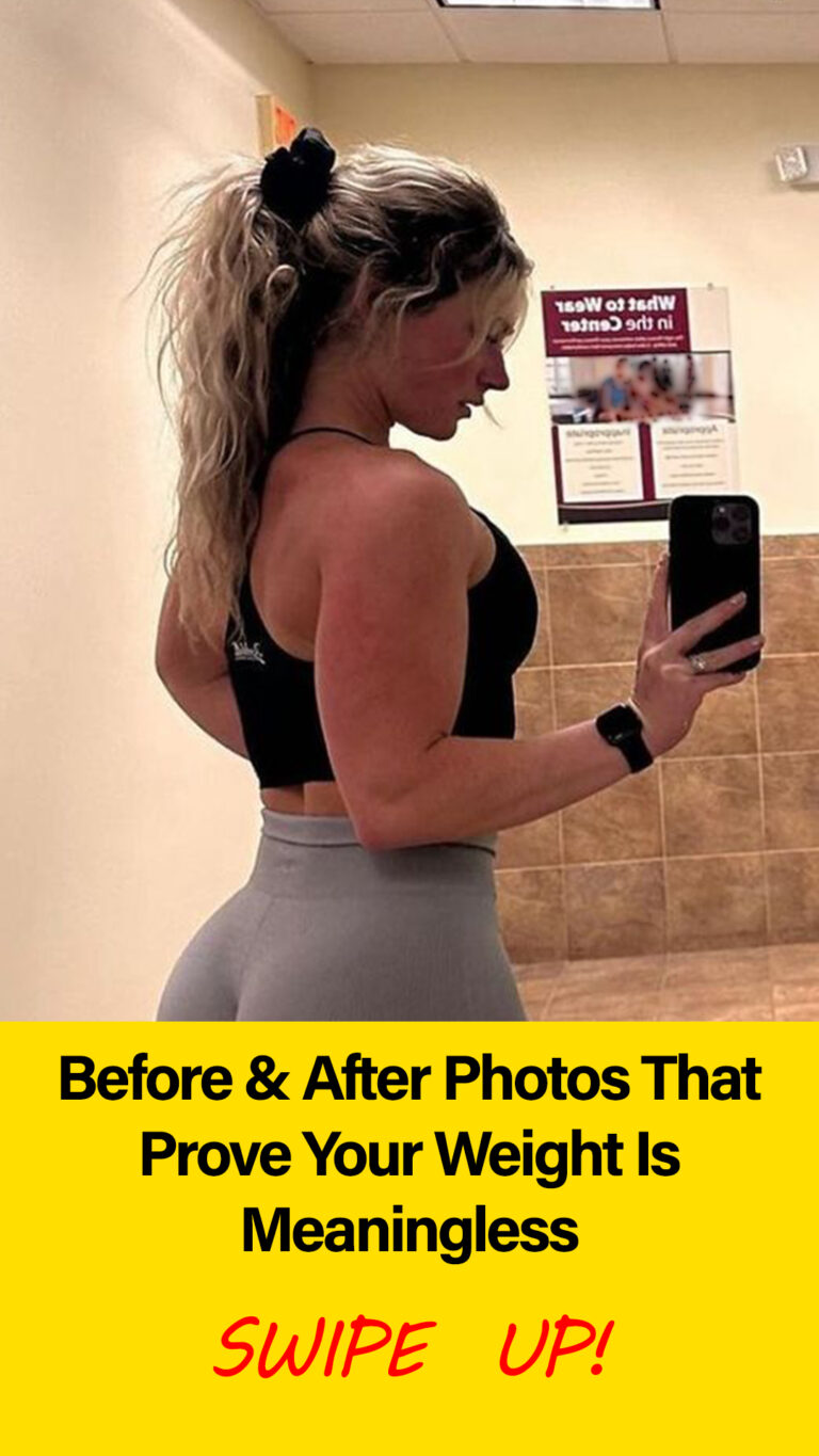 Before & After Photos That Prove Your Weight Is Meaningless