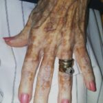 Nurse takes photo of old lady’s hand – then sees detail in the picture that has the internet exploding