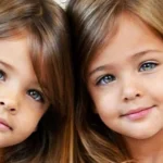 Identical Sisters Born in 2010 Grew Up to Become ‘Most Beautiful Twins in the World’ — How the Girls Look Now