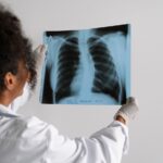 Kansas Tuberculosis Outbreak Becomes Largest in U.S. History with 67 Active Cases Reported Across Two Counties – Latest Updates