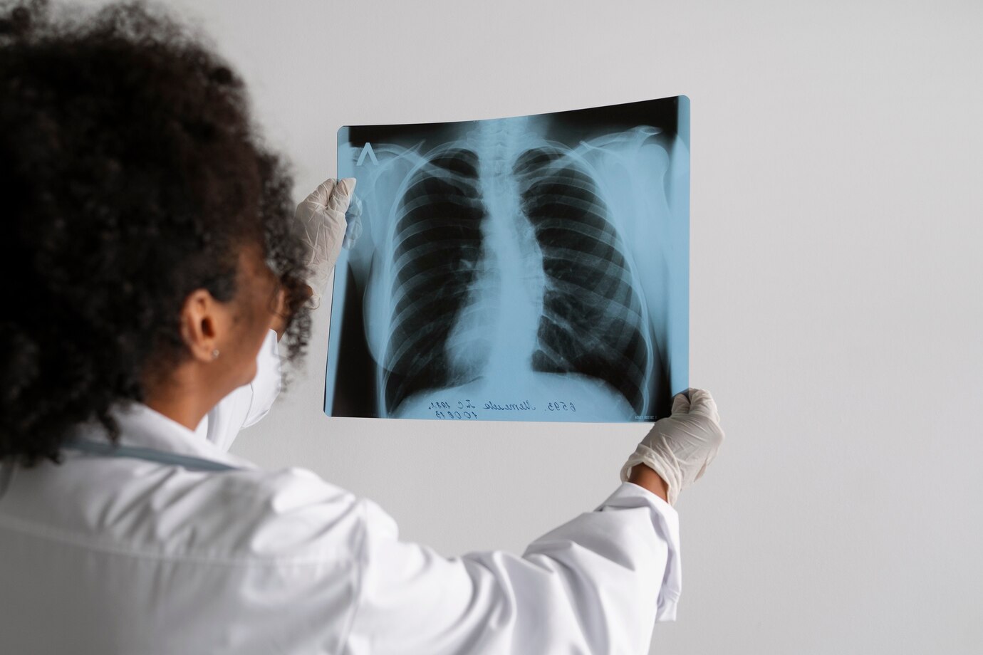 Kansas Tuberculosis Outbreak Becomes Largest in U.S. History with 67 Active Cases Reported Across Two Counties – Latest Updates