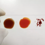 Scientists discover new blood type only found in one woman on earth today
