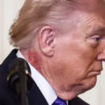 Donald Trump sparks fresh health concerns with scabbing neck rash
