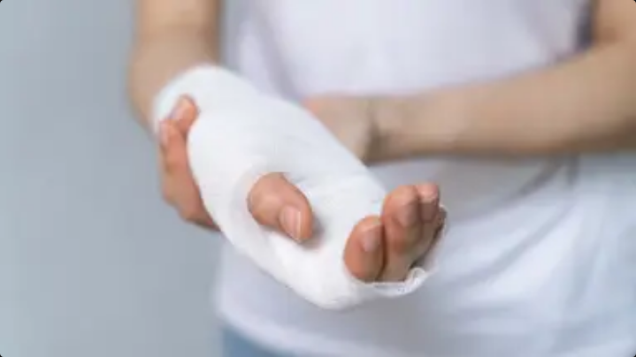 This is what actually happens to your body when you break a bone