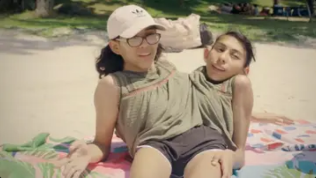 Conjoined twin reveals what happens when sister is intimate with her husband