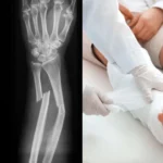 Mind-Blowing Theory About People Who Have ‘Never Broken A Bone’