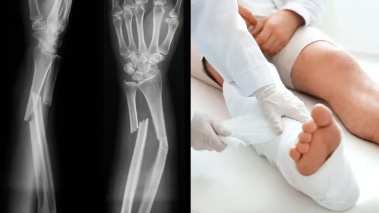 Mind-Blowing Theory About People Who Have ‘Never Broken A Bone’