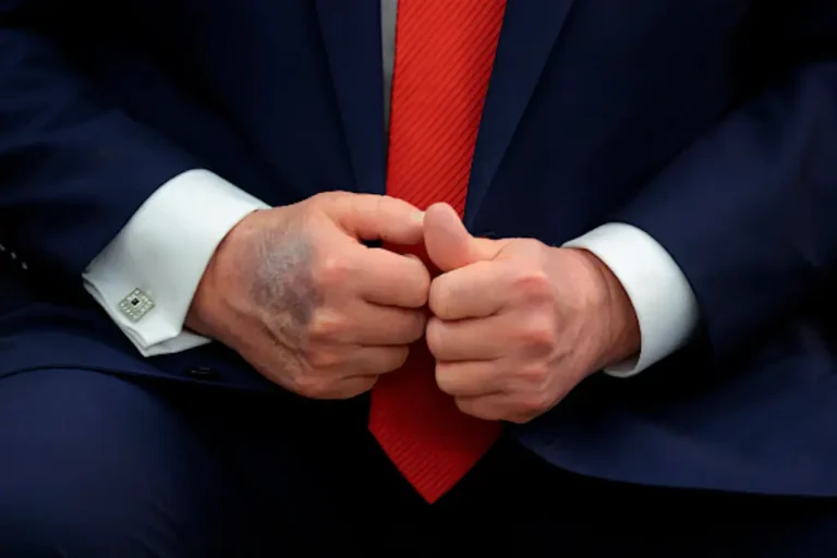 Donald Trump’s own lawyer turns on him as they call for major amendment to be invoked