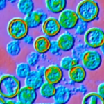 Officials share next steps for hantavirus outbreak as cases rise
