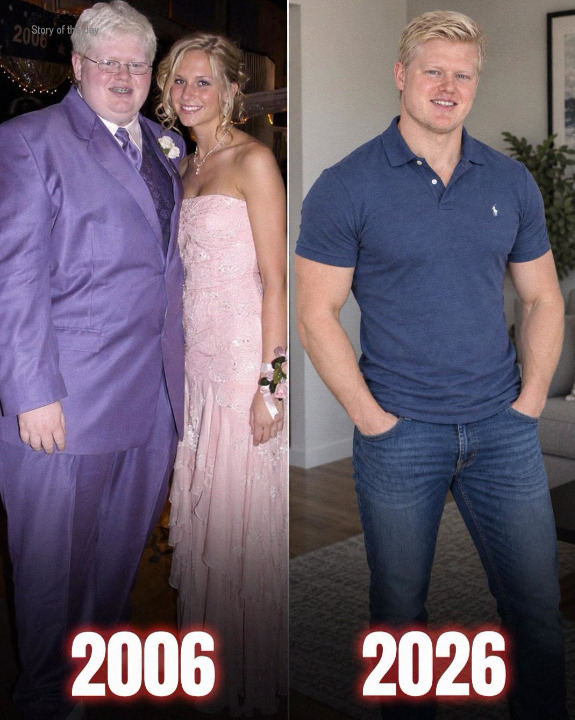 The School’s Most Beautiful Girl Invited Me to Prom While Everyone Else Teased Me for My Looks – 20 Years Later, She Didn’t Recognize Me, and What I Did Changed Her Life